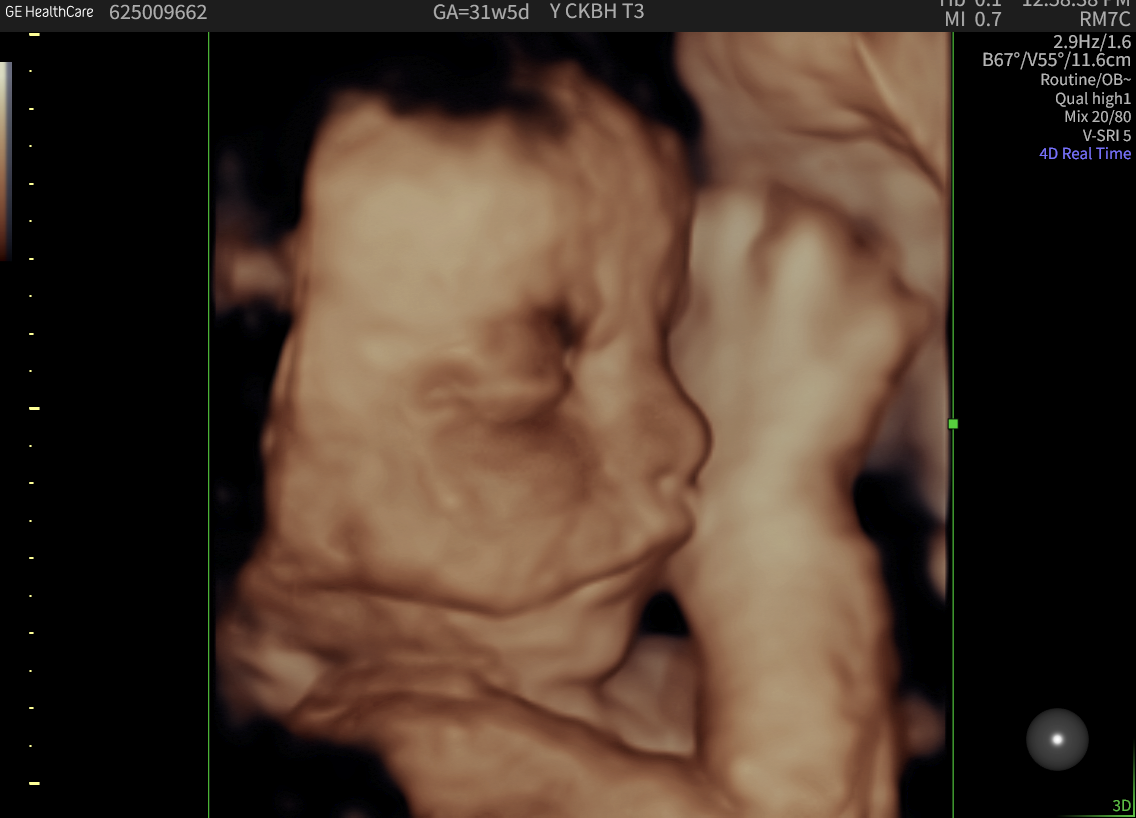3D 3rd Trimester