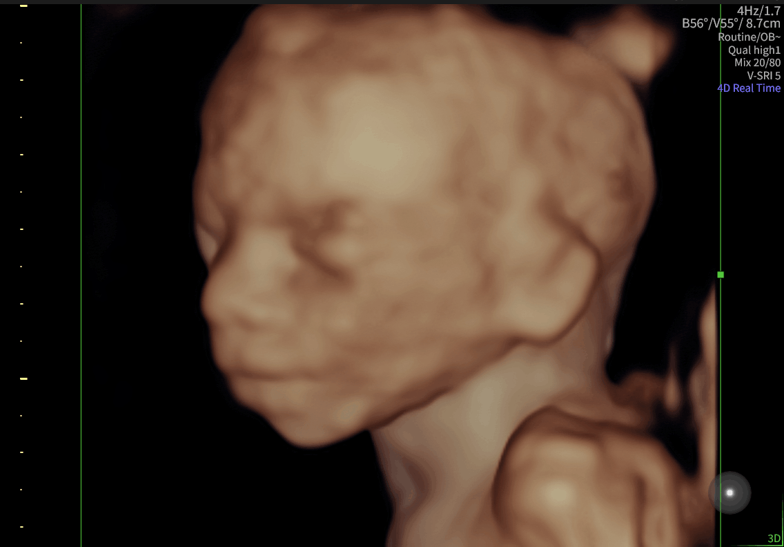 3D Anatomy